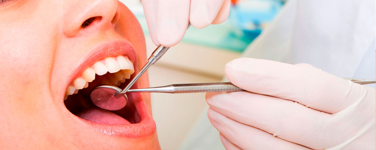 Implante dental calle goya